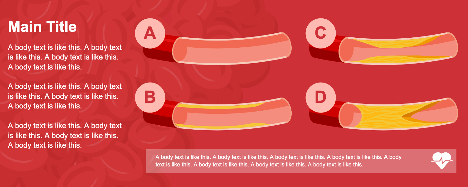 Graphical Abstracts template Arterial disease progression